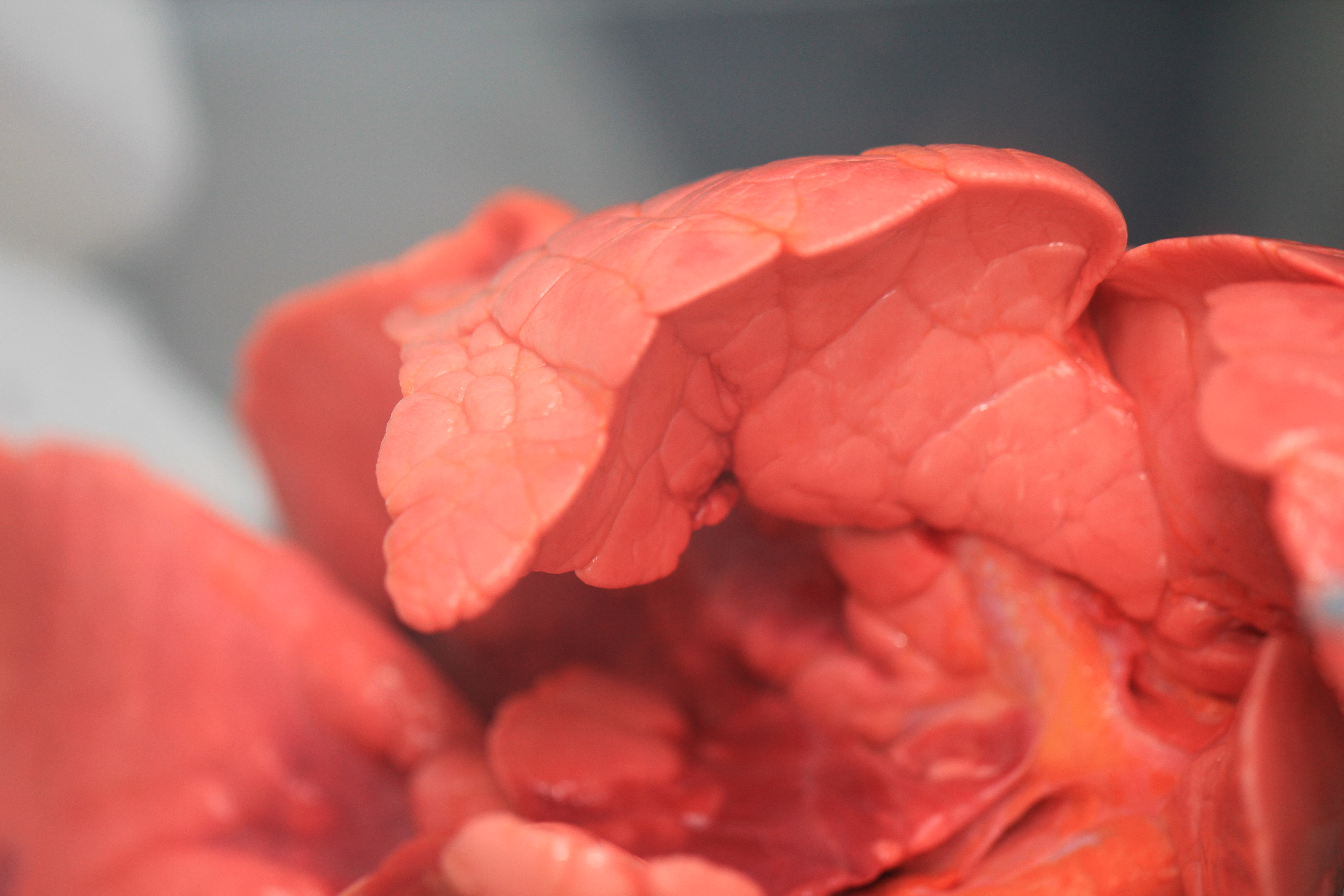 Lung Tissue Makro